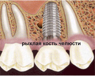 http://osteomed.su/images/home/stomatolog.jpg