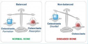 Баланс и дисбаланс остеобластов и остеокластов