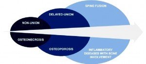 Мишени костных условий (Bone conditions targeted) и стратегия «Bone Therapeutics» (Источник: Bone Therapeutics)