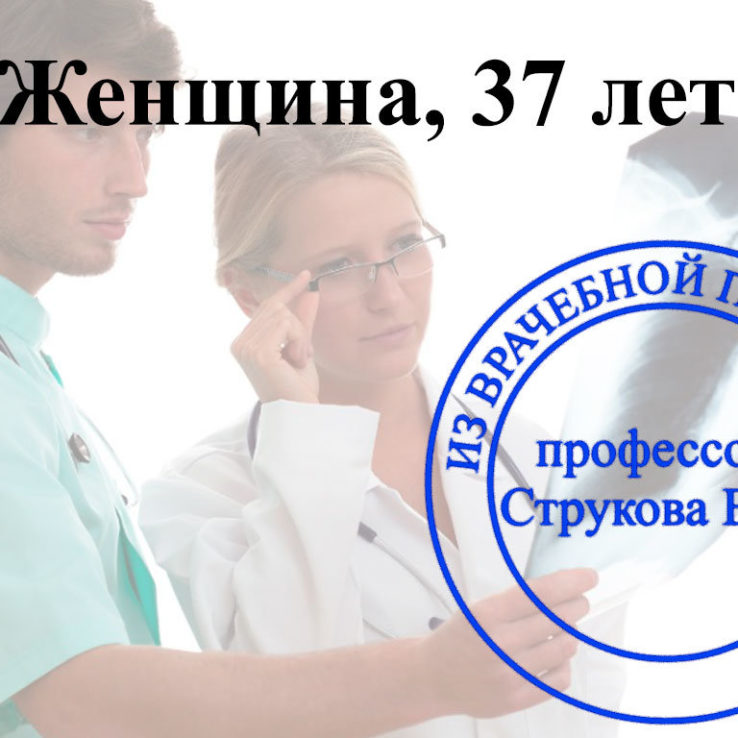 аномальная форма груди