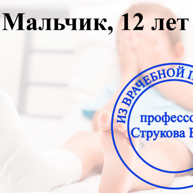 атипичный остеопороз в 12 лет