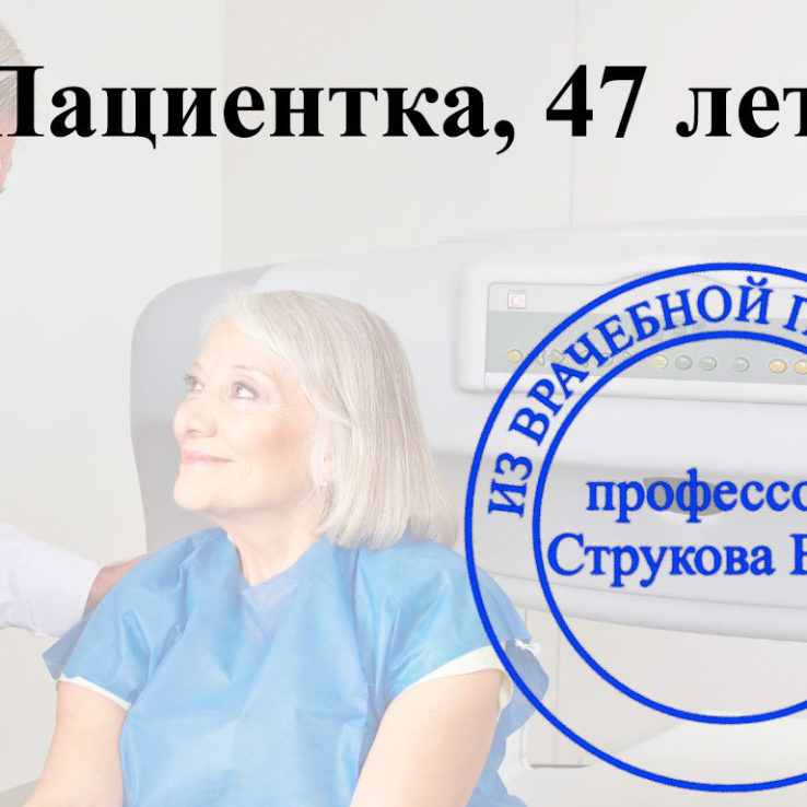 денситометрия
