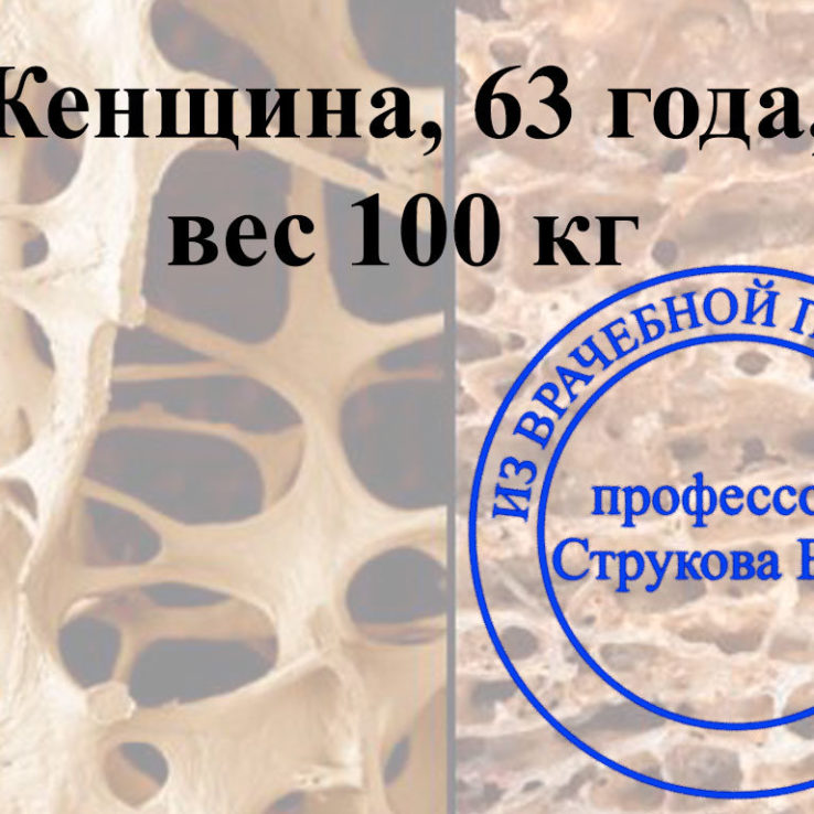 комборбидный остеопороз с полостями