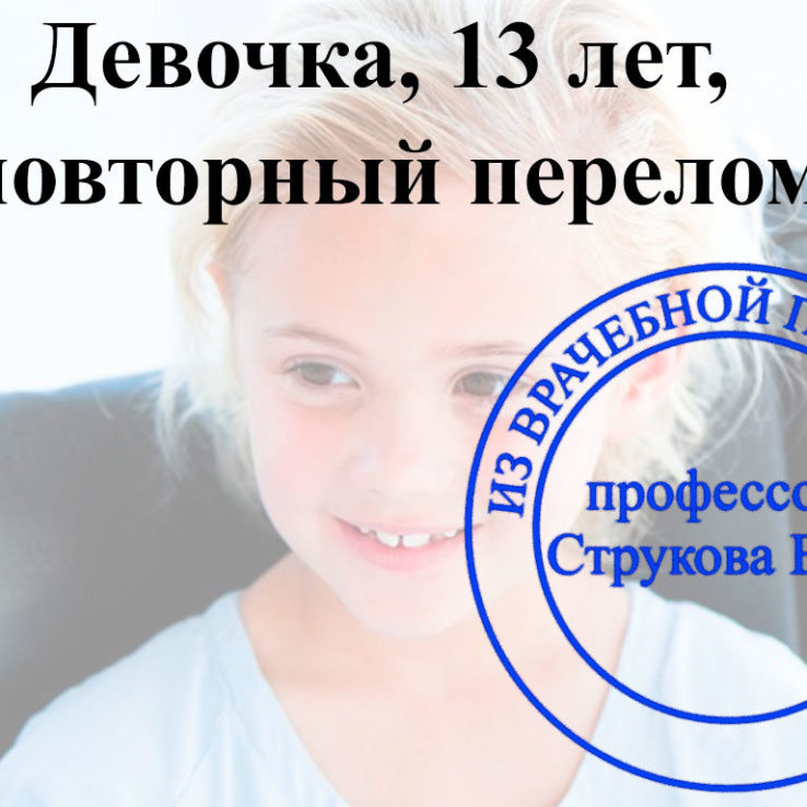 несовершенный остеогенез у детей