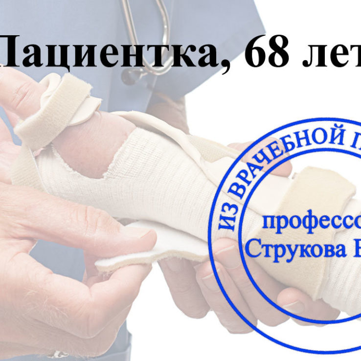 остеопороз с полостными переломами