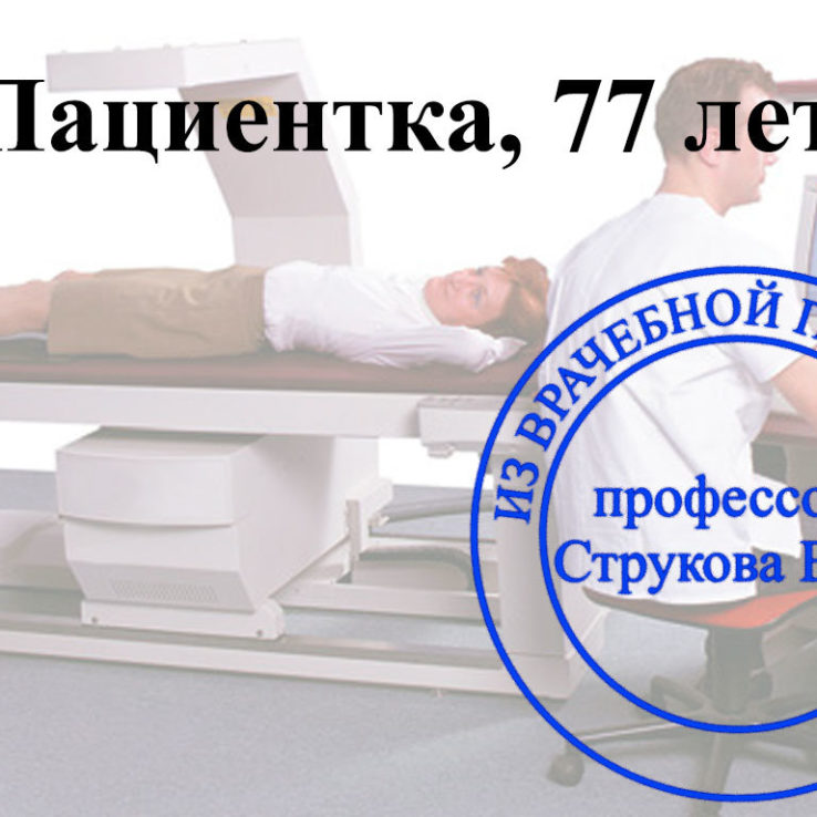 результаты денситометрии