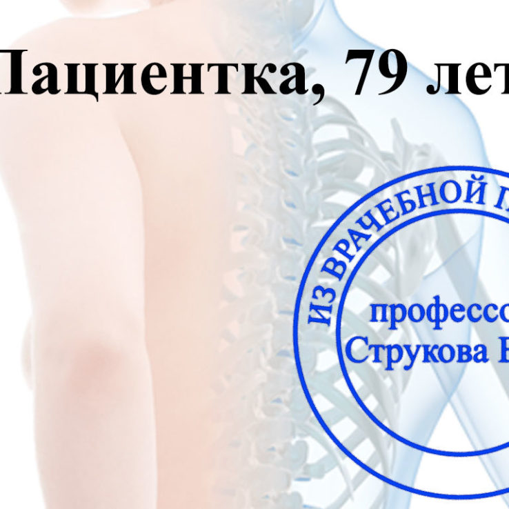 системный остеопороз