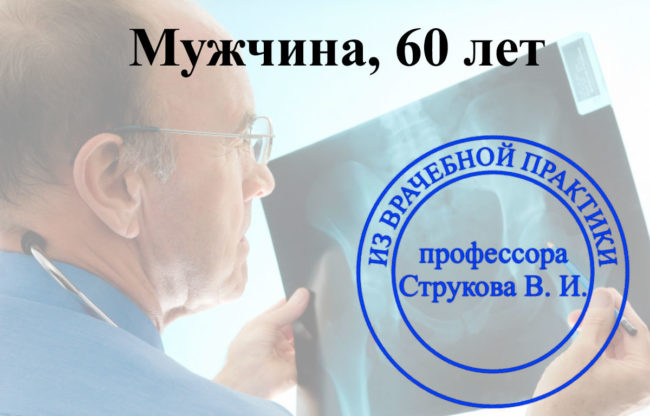 osteopeniya 3 stepeni остеопороз 3 степени