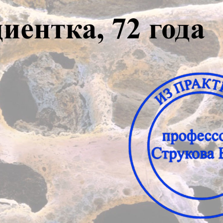 выраженный остеопороз с полостями
