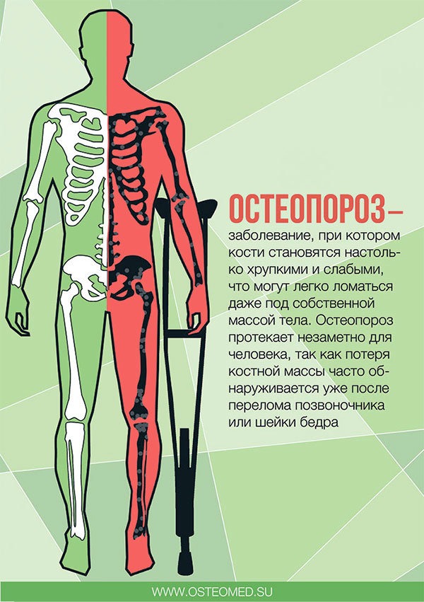 lechenie-osteoporoza-preparaty01