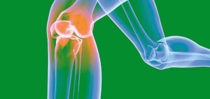 Артрит коленного сустава симптомы