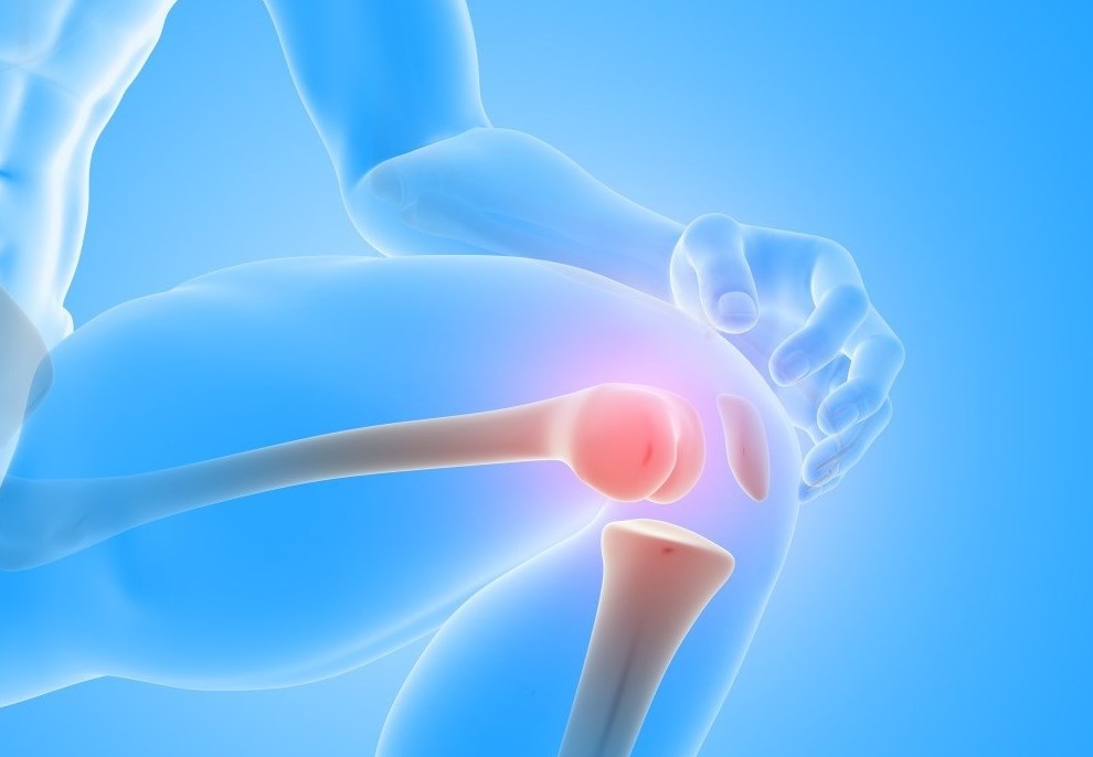 лечение артроза коленного сустава народными средствами