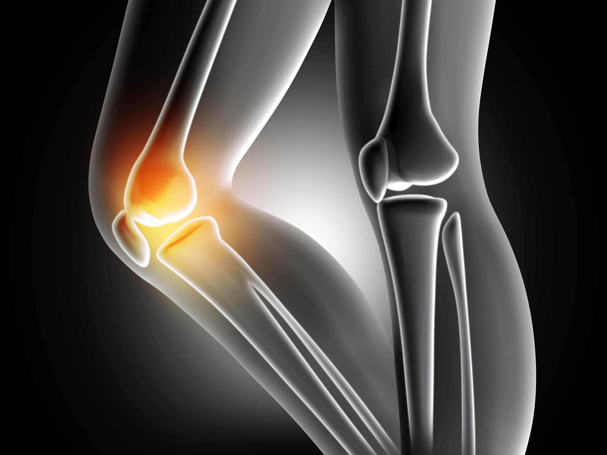 Knee arthroplasty. Здоровый коленный сустав. Здоровые колени. Красивые и Здоровые колени. Здоровый коленный сустав фото.